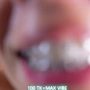 Sexy live cam screenshot of mon1_day's webcam / video chat room